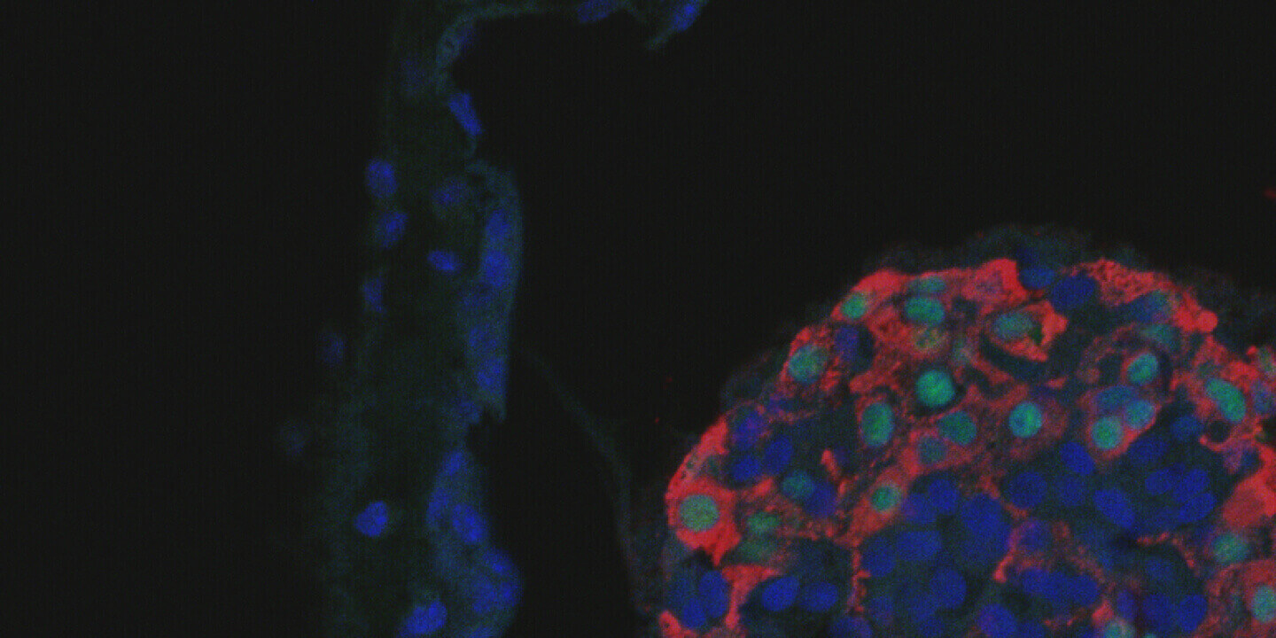 Scientific image of stem cells: insulin-producing beta cells.